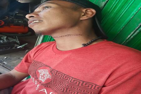 Kabel Jalur Wifi Telan Korban Kecelaka